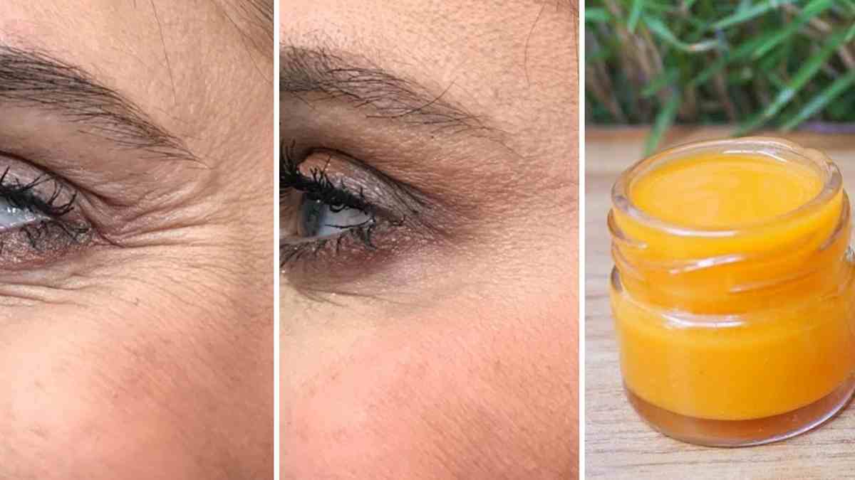 Voici un masque miraculeux à la vitamine C avec effet botox