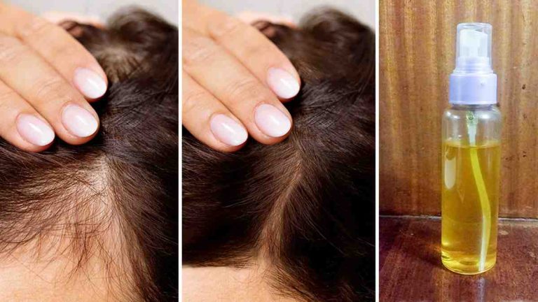 utiliser le vinaigre de cidre de pomme pour faire repousser les cheveux