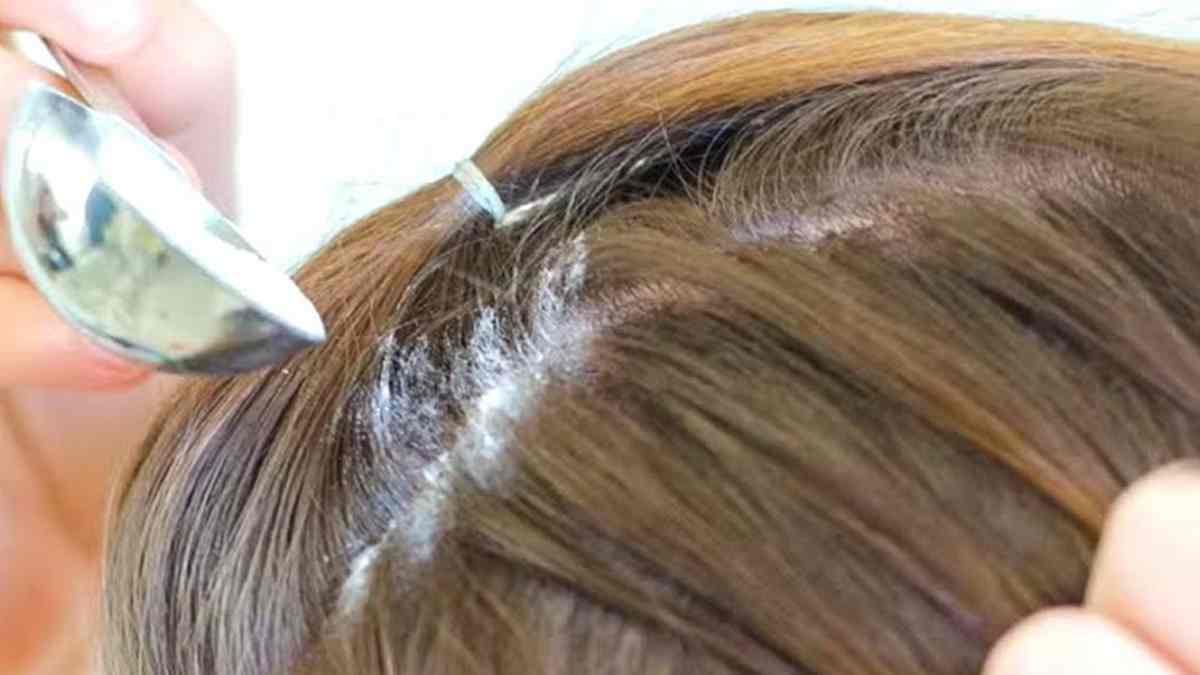 repousse des cheveux avec du bicarbonate de soude