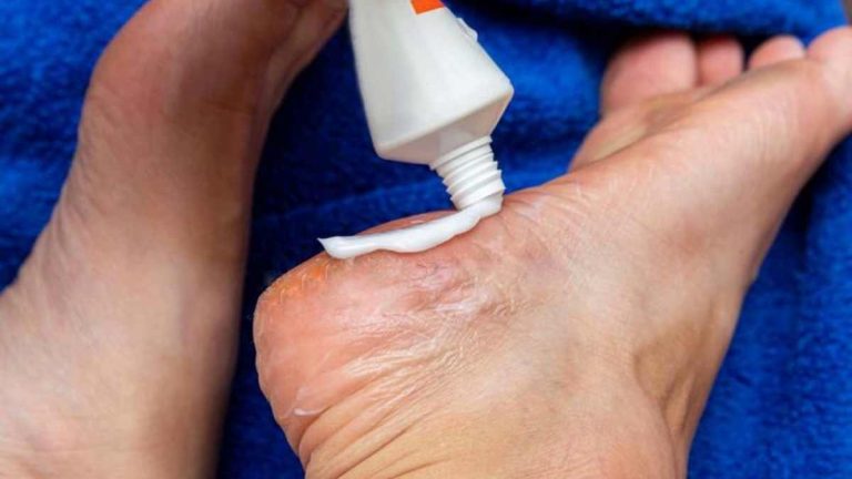 Appliquer du dentifrice sur les pieds